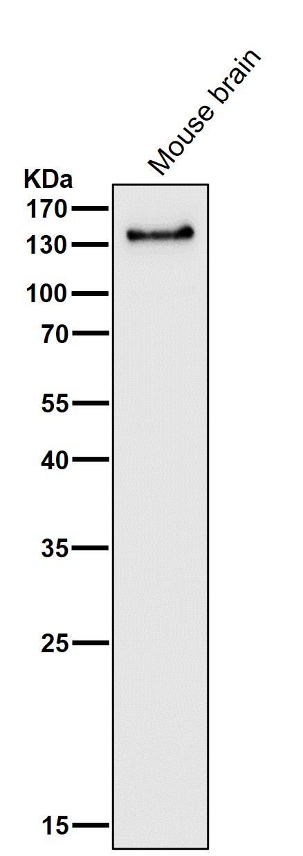 All lanes use the Antibody at 1:3K dilution for 1 hour at room temperature