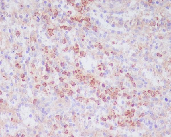 m01080 1 ihc