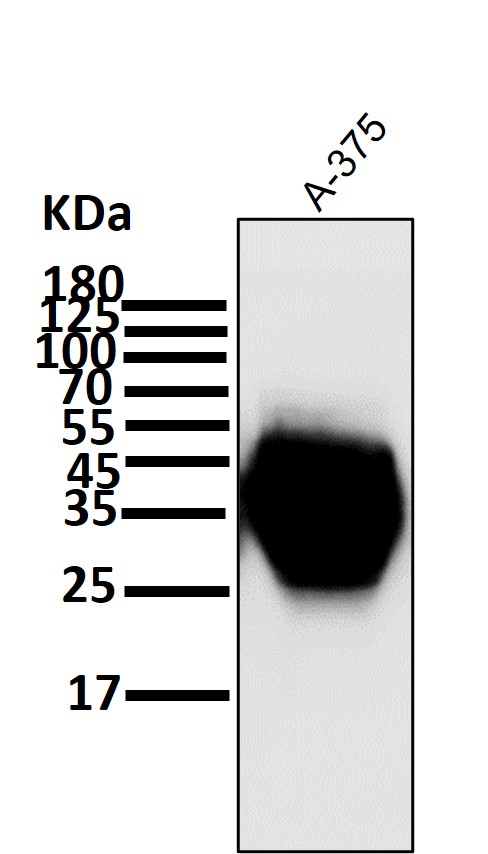 All lanes use the Antibody at 1:1K dilution for 1 hour at room temperature