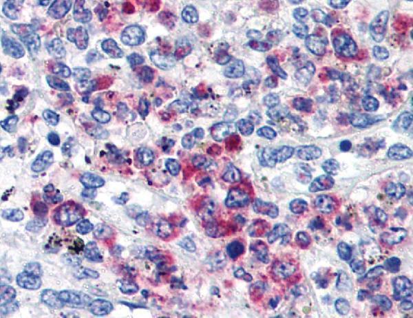 m01080 2 hu cd63 primary antibodies ihc testing 1