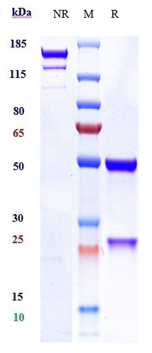 Anti-PAR2 Reference Antibody (PAR650097) on SDS-PAGE under reducing (R) condition