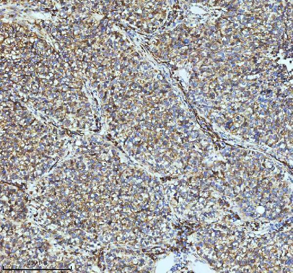 m01081 par2 primary antibodies ihc testing 14