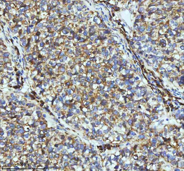 m01081 par2 primary antibodies ihc testing 15