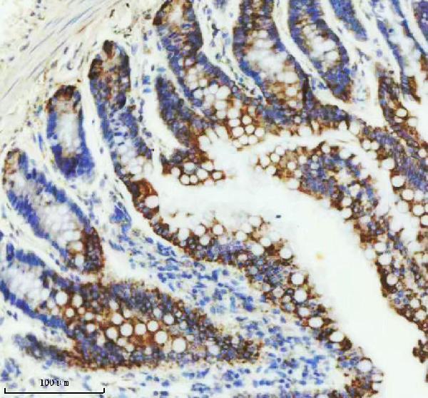 m01081 par2 primary antibodies ihc testing 17