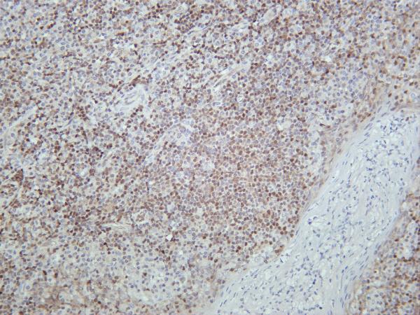 m01083 5 ca9 primary antibodies ihc testing 1