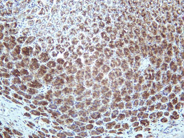 m01083 5 ca9 primary antibodies ihc testing 2
