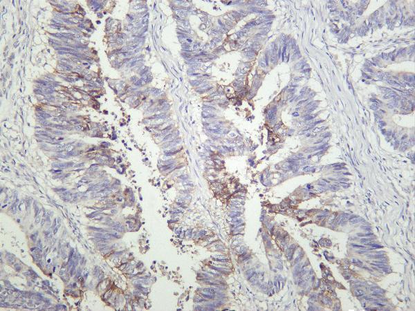 m01083 5 ca9 primary antibodies ihc testing 3