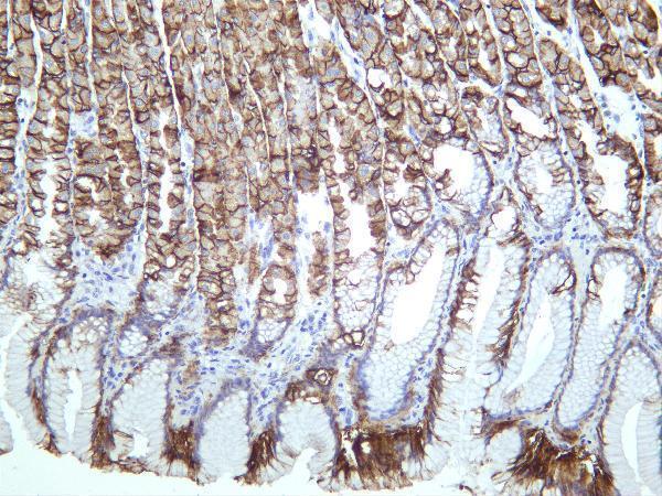 m01083 5 ca9 primary antibodies ihc testing 4