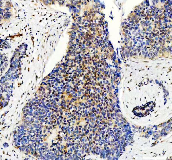 m01087 1 stat5a primary antibodies ihc testing 1