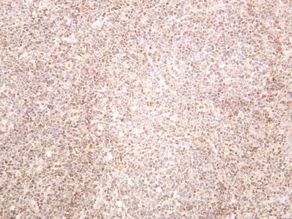 m01087 4 stat5a primary antibodies ihc testing 1