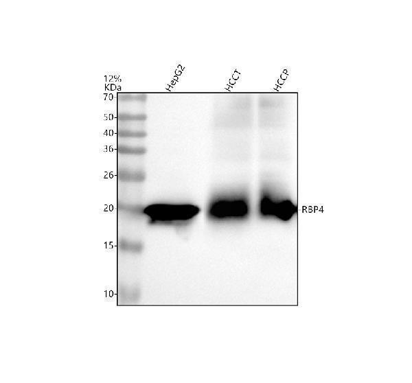 Western blot analysis of RBP4 using anti-RBP4 antibody (M01089)