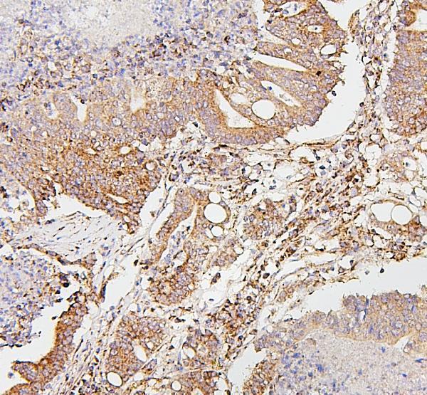 m01090 2 sdhb primary antibodies ihc testing 2