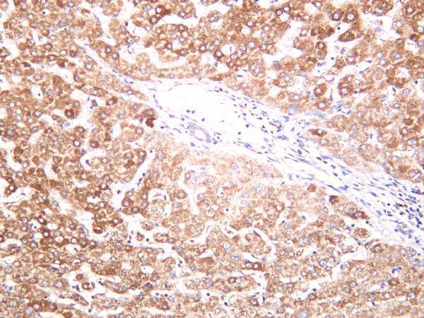 Human liver was stained with anti-SDHB rabbit antibody