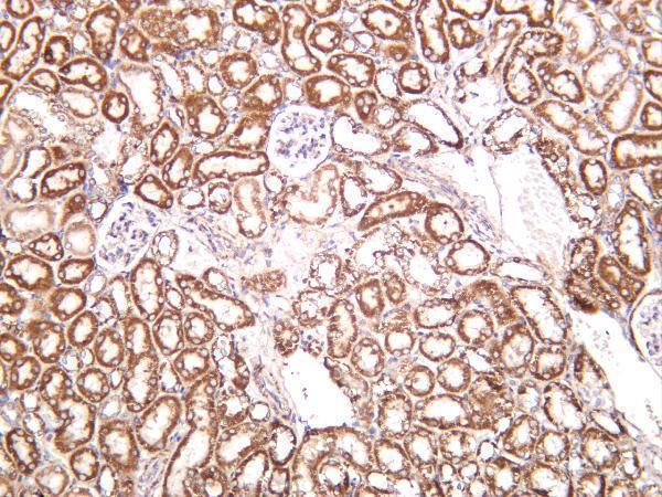 m01090 5 sdhb primary antibodies ihc testing 4