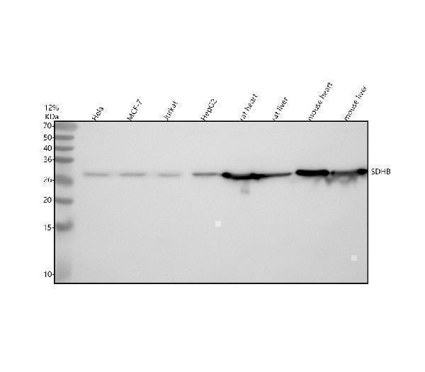  Western blot analysis of SDHB using anti-SDHB antibody (M01090)