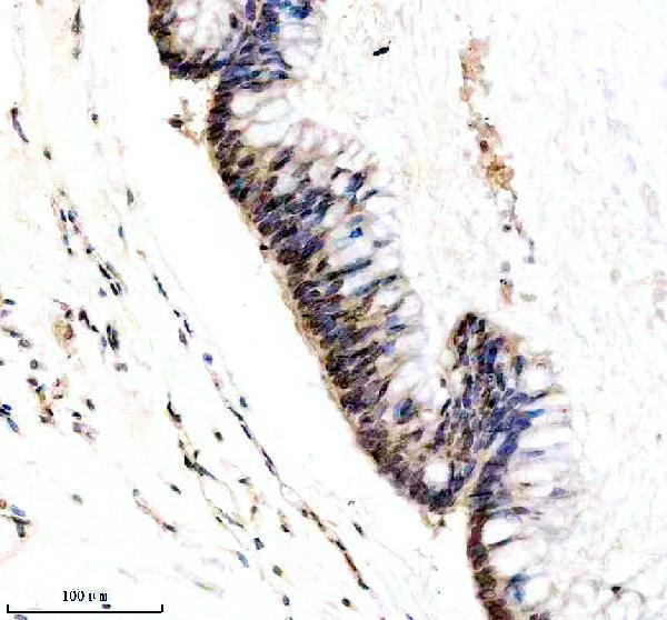 m01091 1 1 pik3cb primary antibodies ihc testing 1