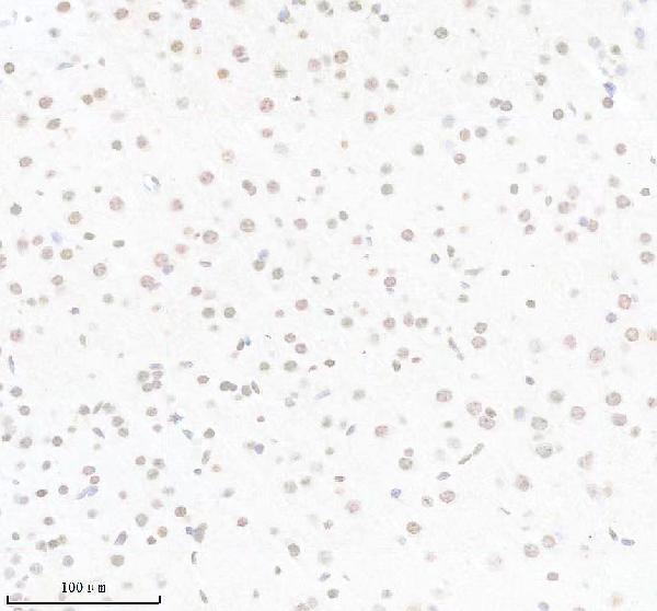 m01091 1 1 pik3cb primary antibodies ihc testing 2