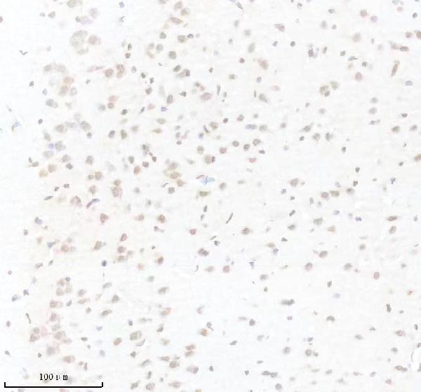m01091 1 1 pik3cb primary antibodies ihc testing 3