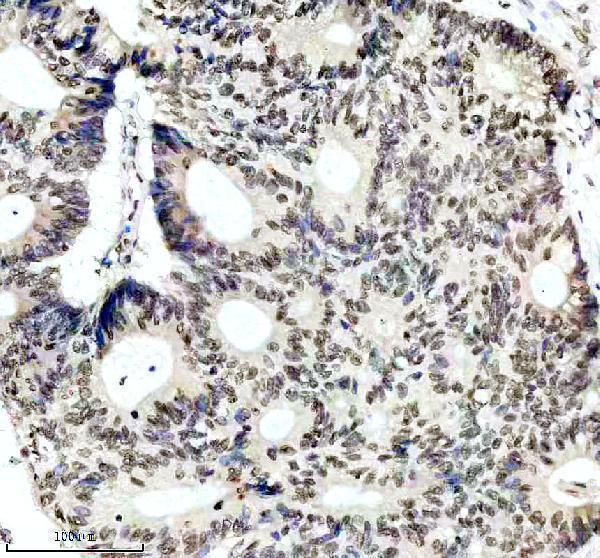 m01091 1 1 pik3cb primary antibodies ihc testing 4