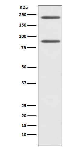 Western blot analysis of C4 expression in HepG2 cell lysate