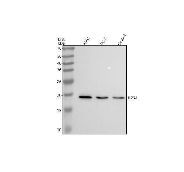 Western blot analysis of IL23 using anti-IL23 antibody (M01097)