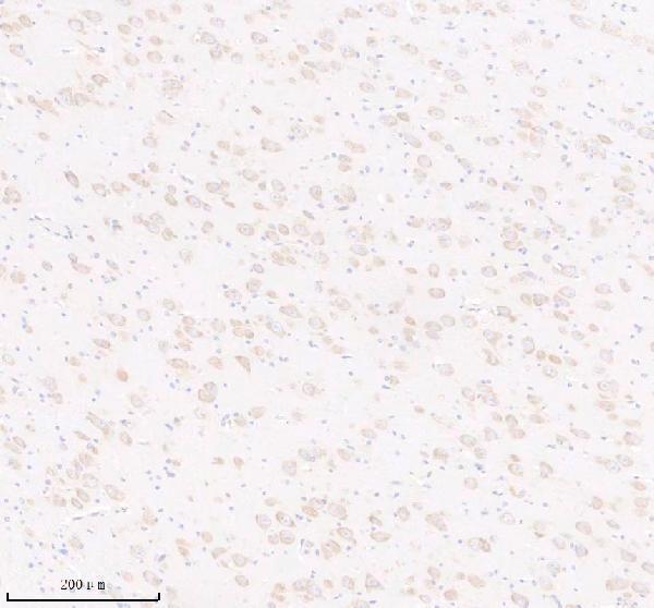 m01101 adora1 primary antibodies ihc testing 1