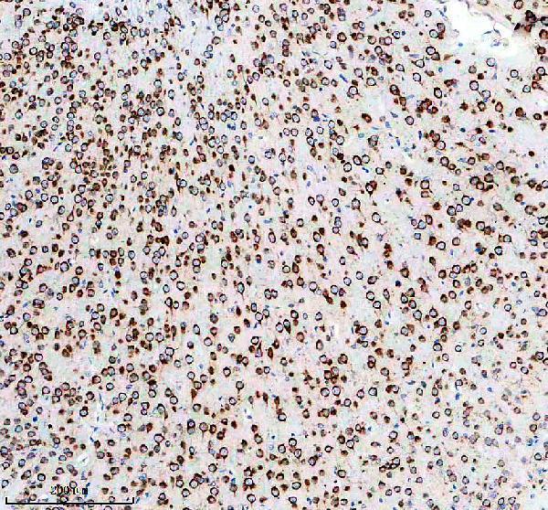 m01101 adora1 primary antibodies ihc testing 2
