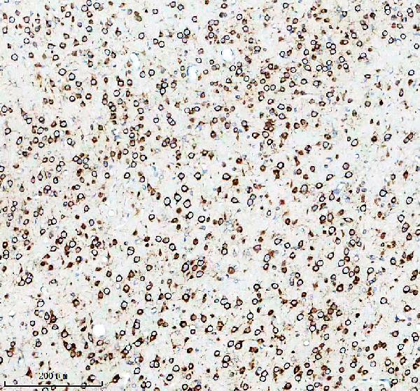 m01101 adora1 primary antibodies ihc testing 3