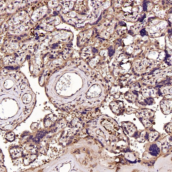 m01102 ihc9