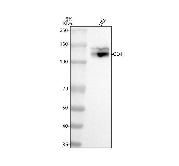  Western blot analysis of ITGA2B using anti-ITGA2B antibody (M01102)
