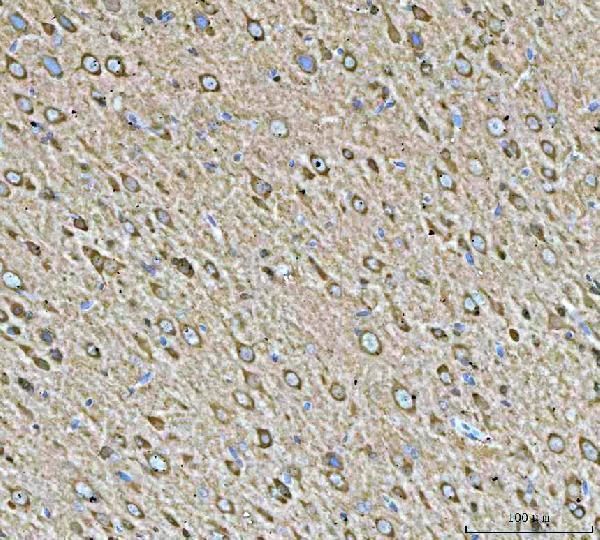 m01103 2 hsp90aa1 primary antibodies ihc testing 2