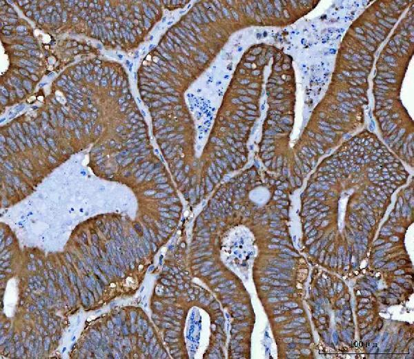 m01103 2 hsp90aa1 primary antibodies ihc testing 4