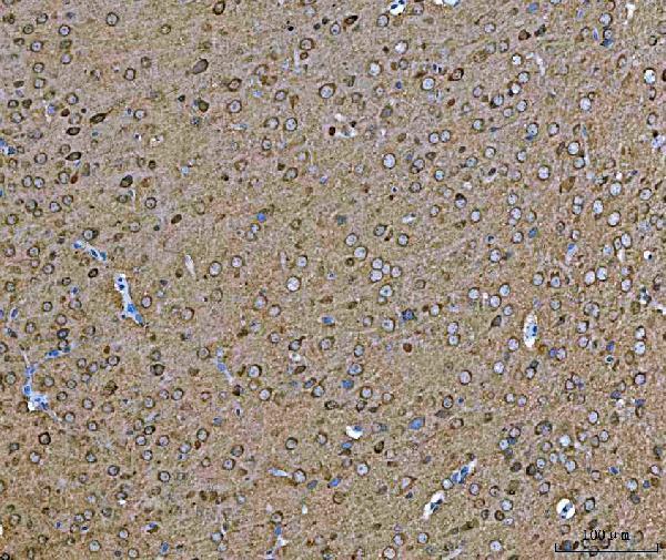 m01103 2 hsp90aa1 primary antibodies ihc testing 7
