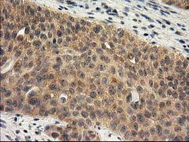 m01104 1 anti rassf1 mouse monoclonal antibody clone id oti2b11 ihc testing 10