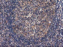 m01104 1 anti rassf1 mouse monoclonal antibody clone id oti2b11 ihc testing 11