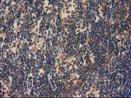 m01104 1 anti rassf1 mouse monoclonal antibody clone id oti2b11 ihc testing 12