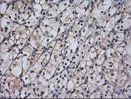 m01104 1 anti rassf1 mouse monoclonal antibody clone id oti2b11 ihc testing 13