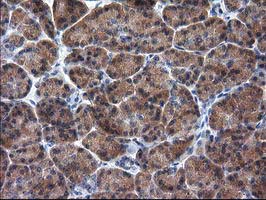m01104 1 anti rassf1 mouse monoclonal antibody clone id oti2b11 ihc testing 4