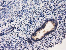 m01104 1 anti rassf1 mouse monoclonal antibody clone id oti2b11 ihc testing 6
