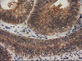 m01104 1 anti rassf1 mouse monoclonal antibody clone id oti2b11 ihc testing 7