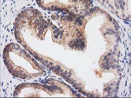 m01104 1 anti rassf1 mouse monoclonal antibody clone id oti2b11 ihc testing 8