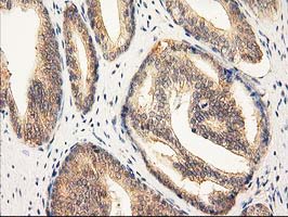 m01104 1 anti rassf1 mouse monoclonal antibody clone id oti2b11 ihc testing 9