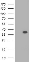 HEK293T cells were transfected with the pCMV6-ENTRY control (Left lane) or pCMV6-ENTRY RASSF1 (Right lane) cDNA for 48 hrs and lysed