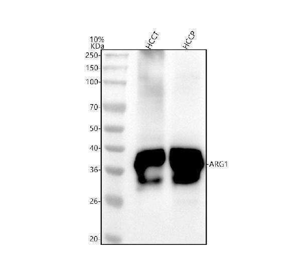  Western blot analysis of ARG1 using anti-ARG1 antibody (M01106-2)