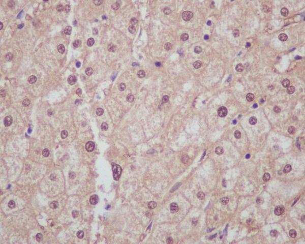 Immunohistochemical analysis of paraffin-embedded human liver, using Liver Arginase Antibody
