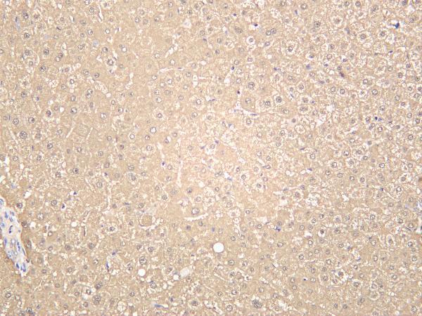 Human liver was stained with anti-Arginase-1 rabbit antibody