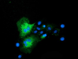 m01117 anti clpp mouse monoclonal antibody clone id oti1f6 if testing 13