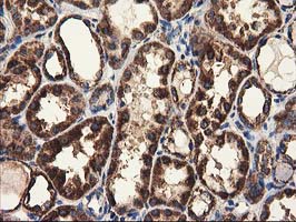 m01117 anti clpp mouse monoclonal antibody clone id oti1f6 ihc testing 10