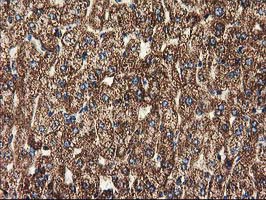 m01117 anti clpp mouse monoclonal antibody clone id oti1f6 ihc testing 11