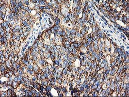 m01117 anti clpp mouse monoclonal antibody clone id oti1f6 ihc testing 4
